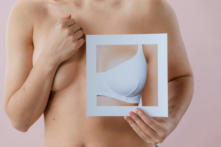 O que é Hormonioterapia de Mama